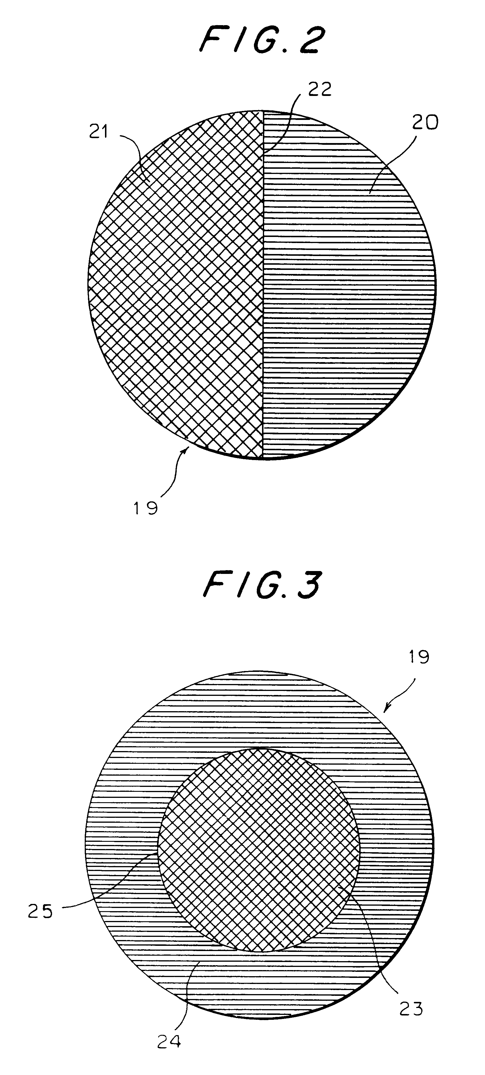 Ocular socket prosthesis