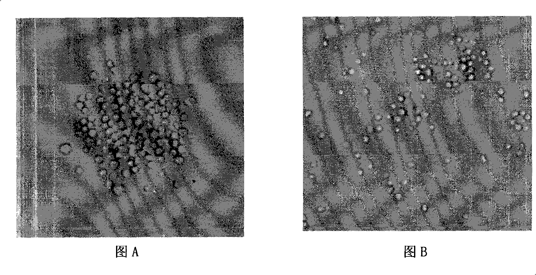 Non-blood serum low density culture medium for animal cell and use thereof