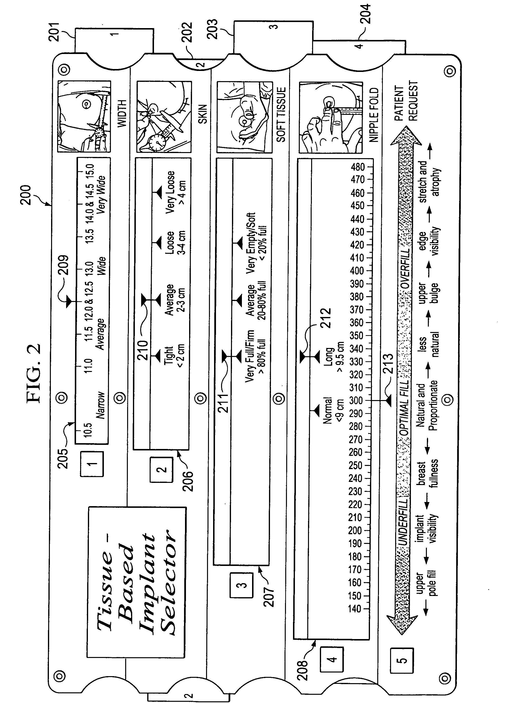 Breast implant selector systems