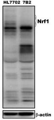 Nrf1β gene directional knockout recognition sequence pair, talens, vector pair and application in human hepatocytes