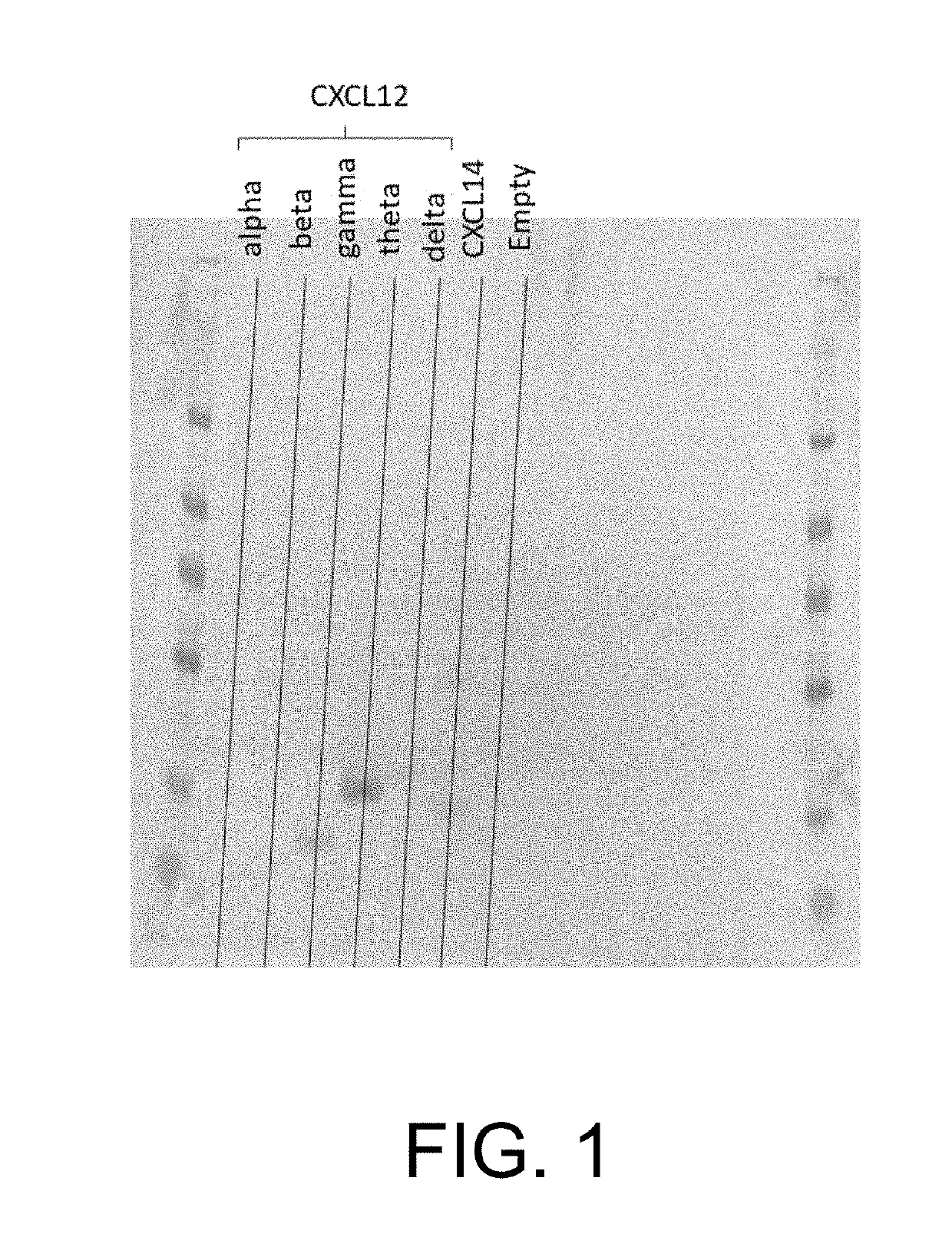 Treating diabetes with genetically modified beta cells