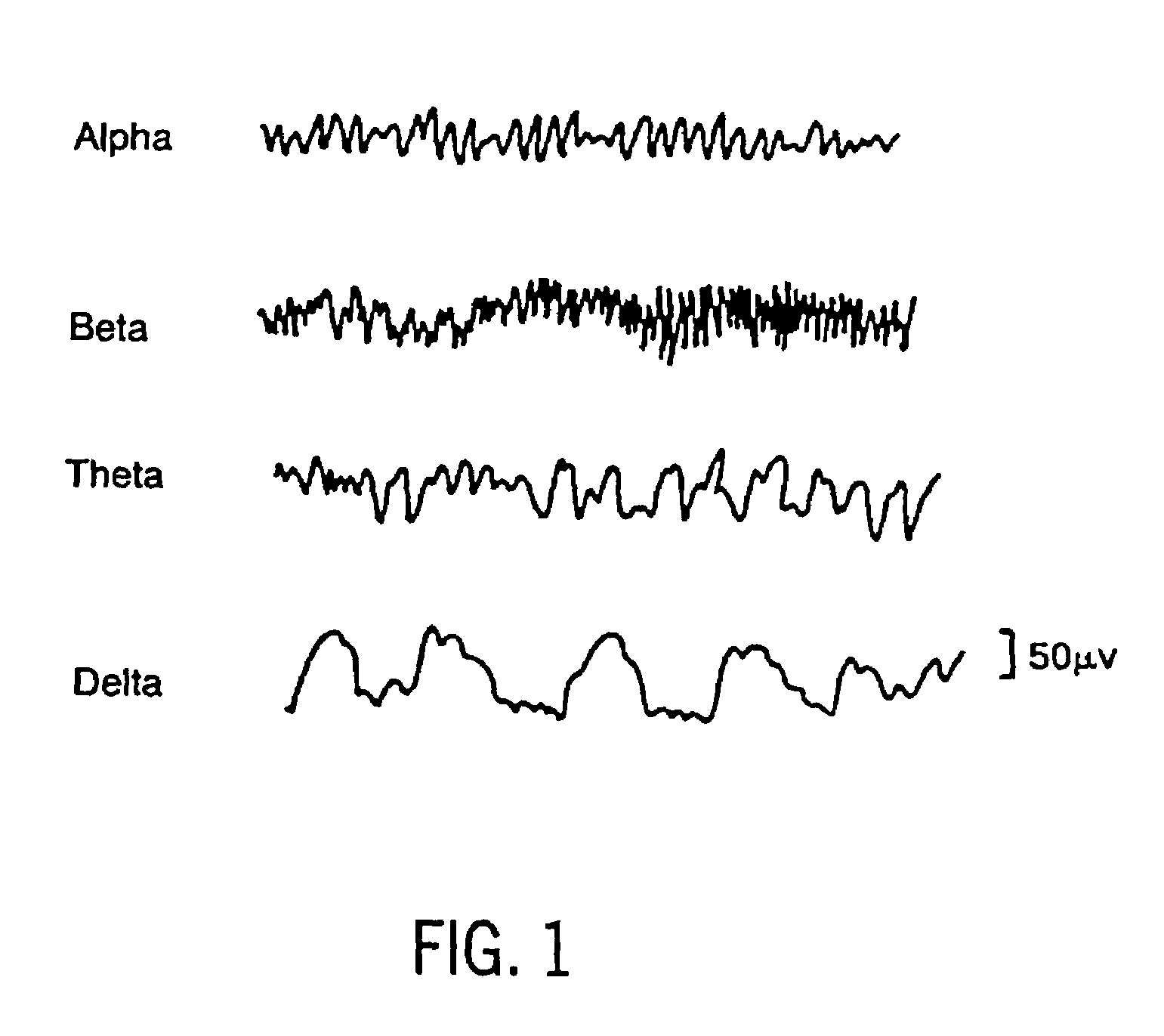 Method and apparatus for determining the cerebral state of a patient using generalized spectral entropy of the EEG signal