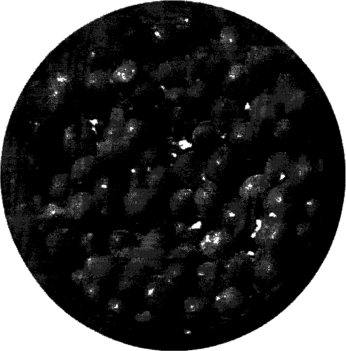 Preparation method of artificial bone scaffold of porous bioceramic microspheres