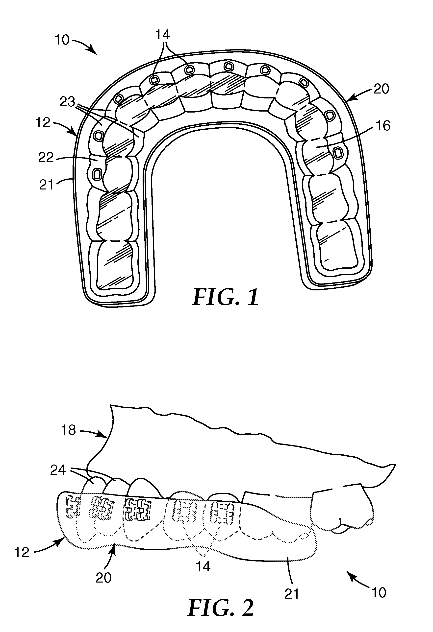 Methods and apparatus for applying dental sealant to an orthodontic patient's teeth