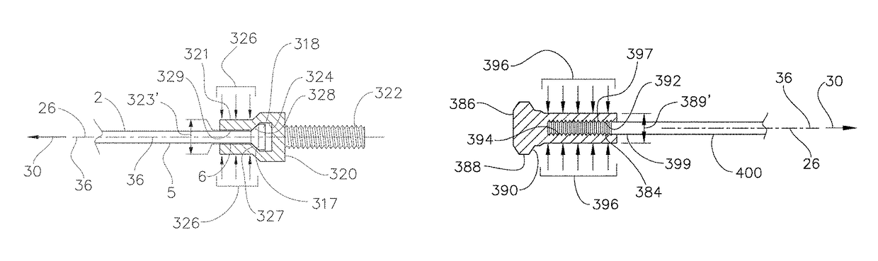 Vehicle wheel spoke connection