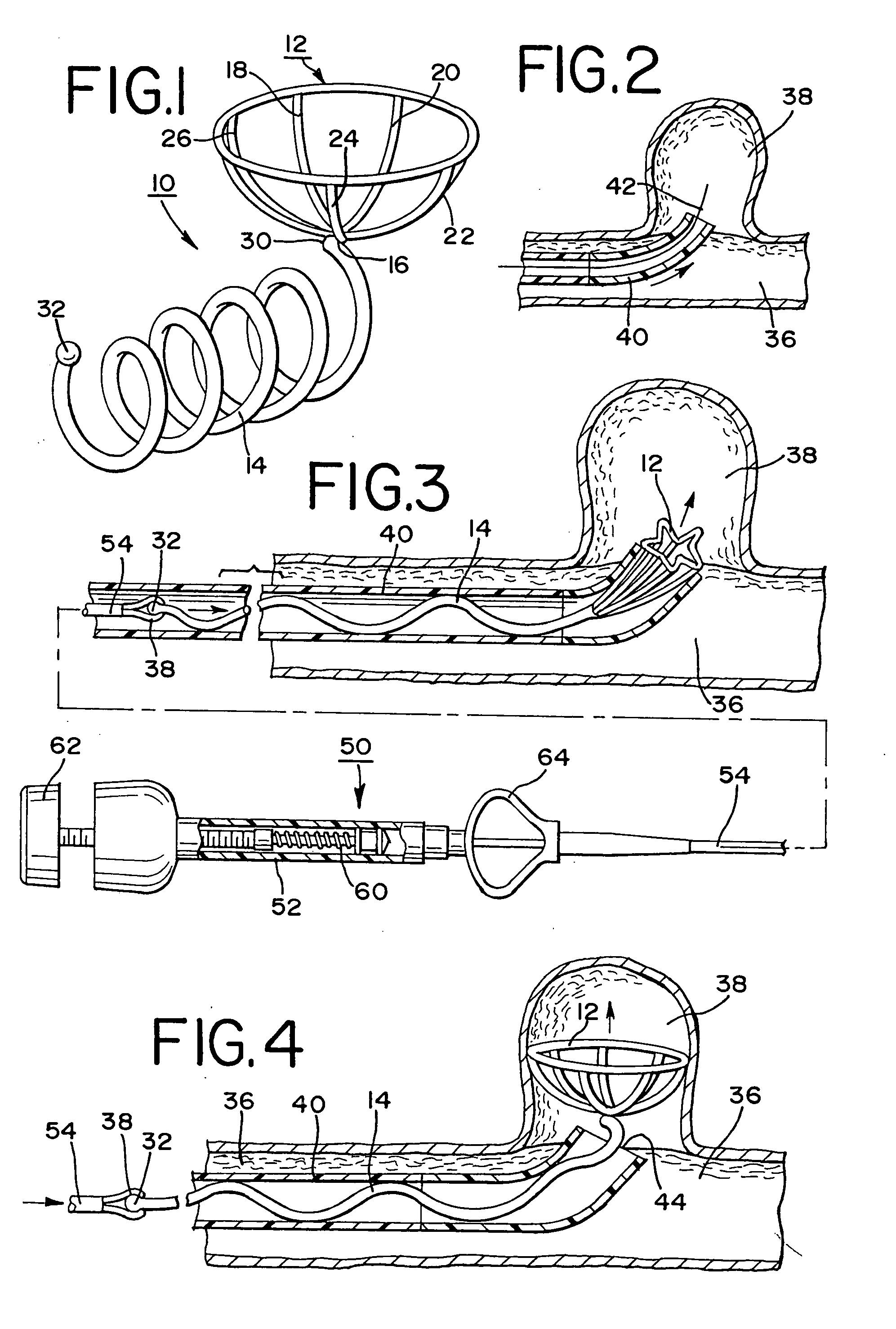 Stent aneurysm embolization device