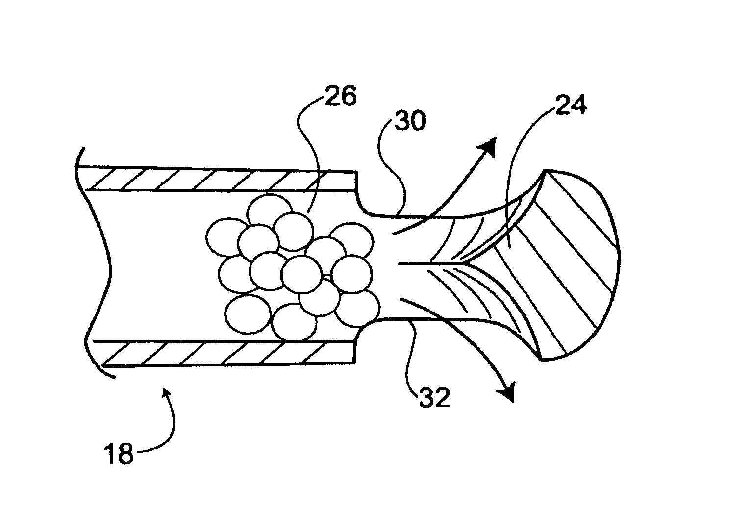 Tool to direct bone replacement material