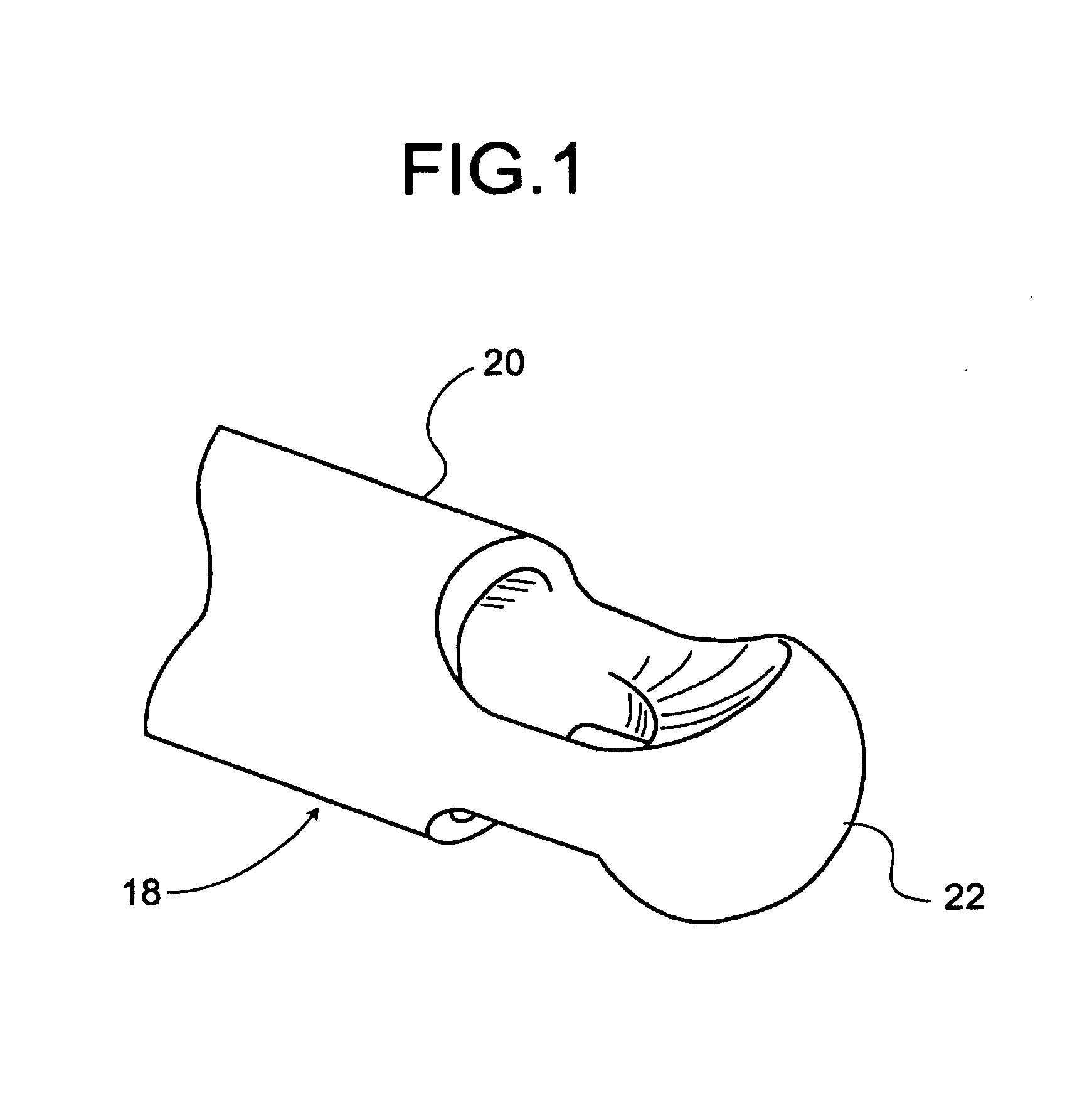 Tool to direct bone replacement material