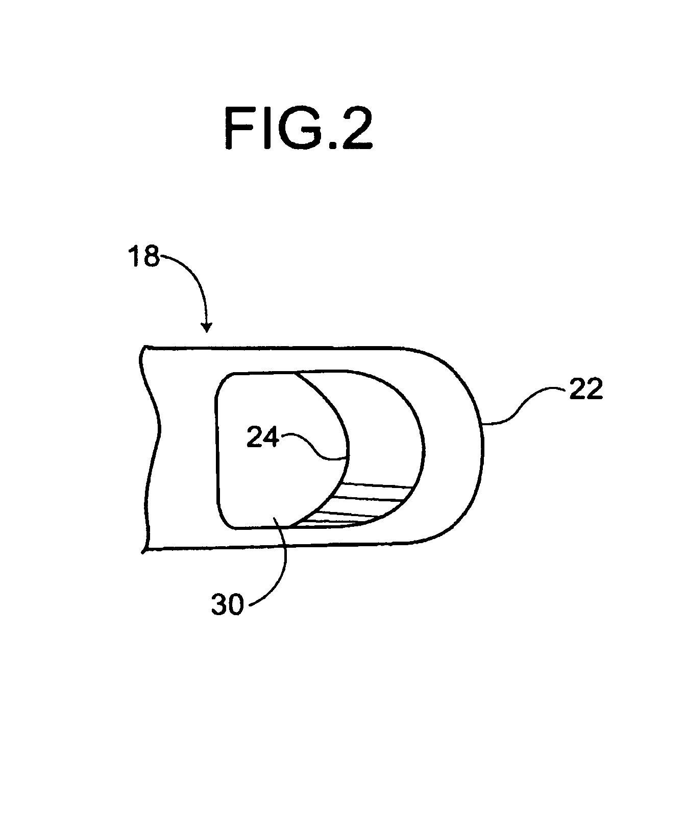 Tool to direct bone replacement material