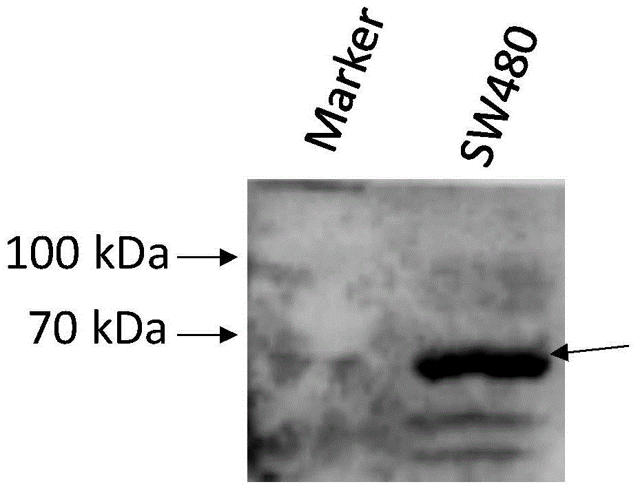 Test method of palmitoylated modified protein based on specific antibody