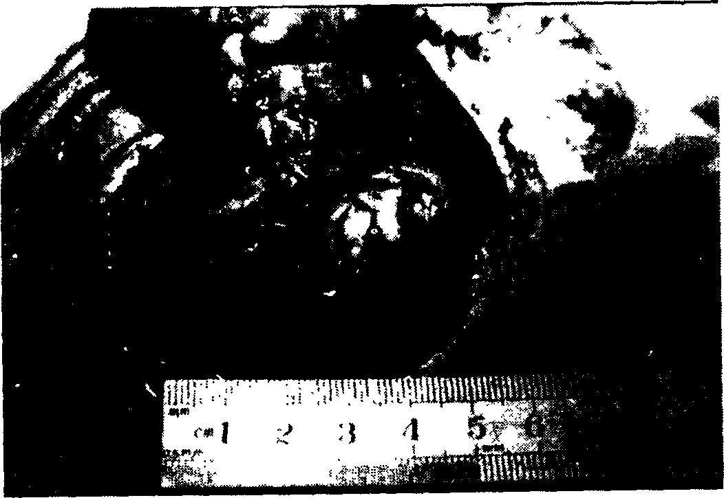 Compound protease medicine for treating prostate proliferation and its preparing method