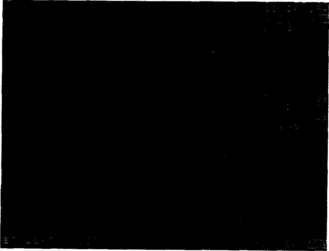 Compound protease medicine for treating prostate proliferation and its preparing method