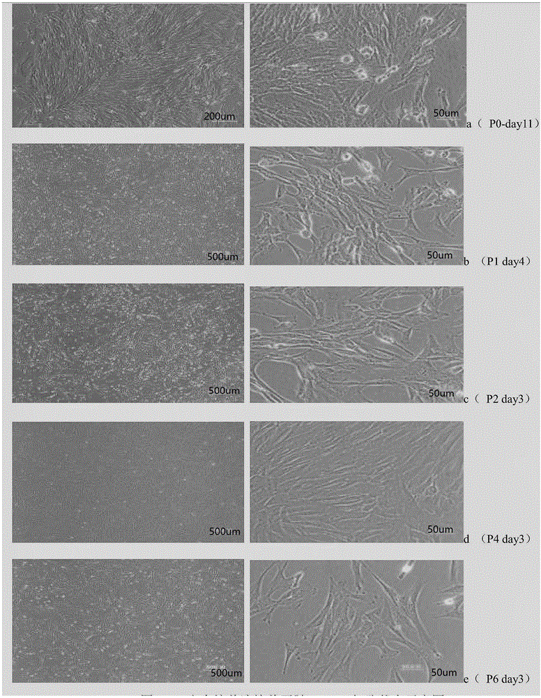 Separation culture method of dental pulp stem cells