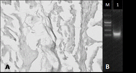 Preparation method of tissue repair material