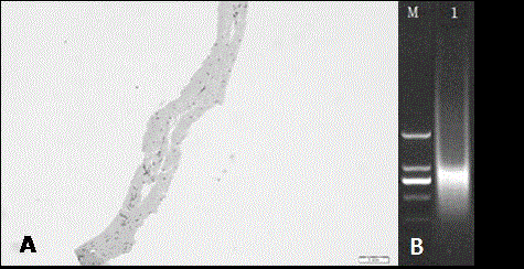 Preparation method of tissue repair material