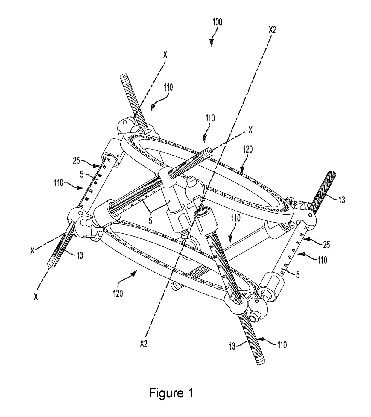 External bone fixation systems