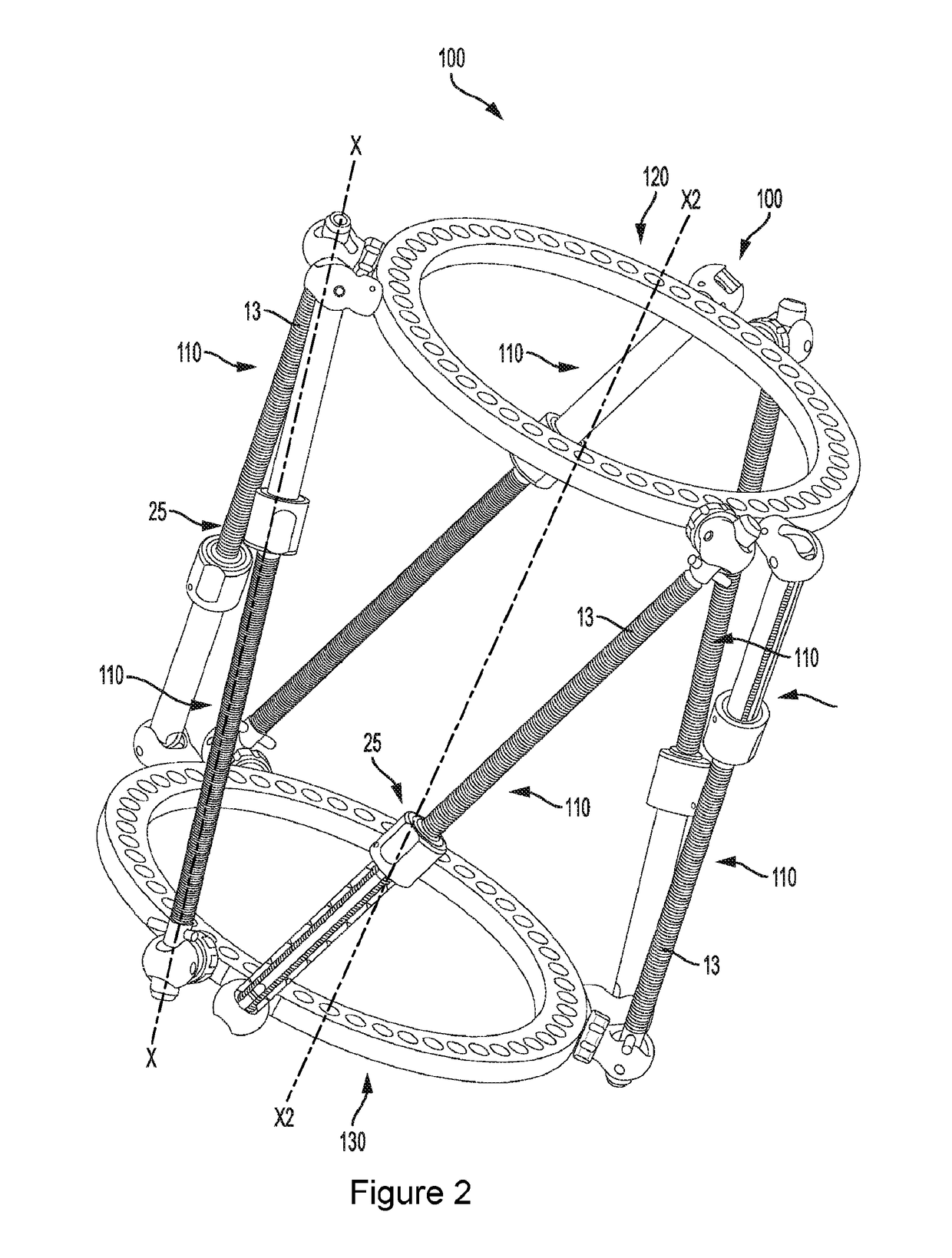 External bone fixation systems