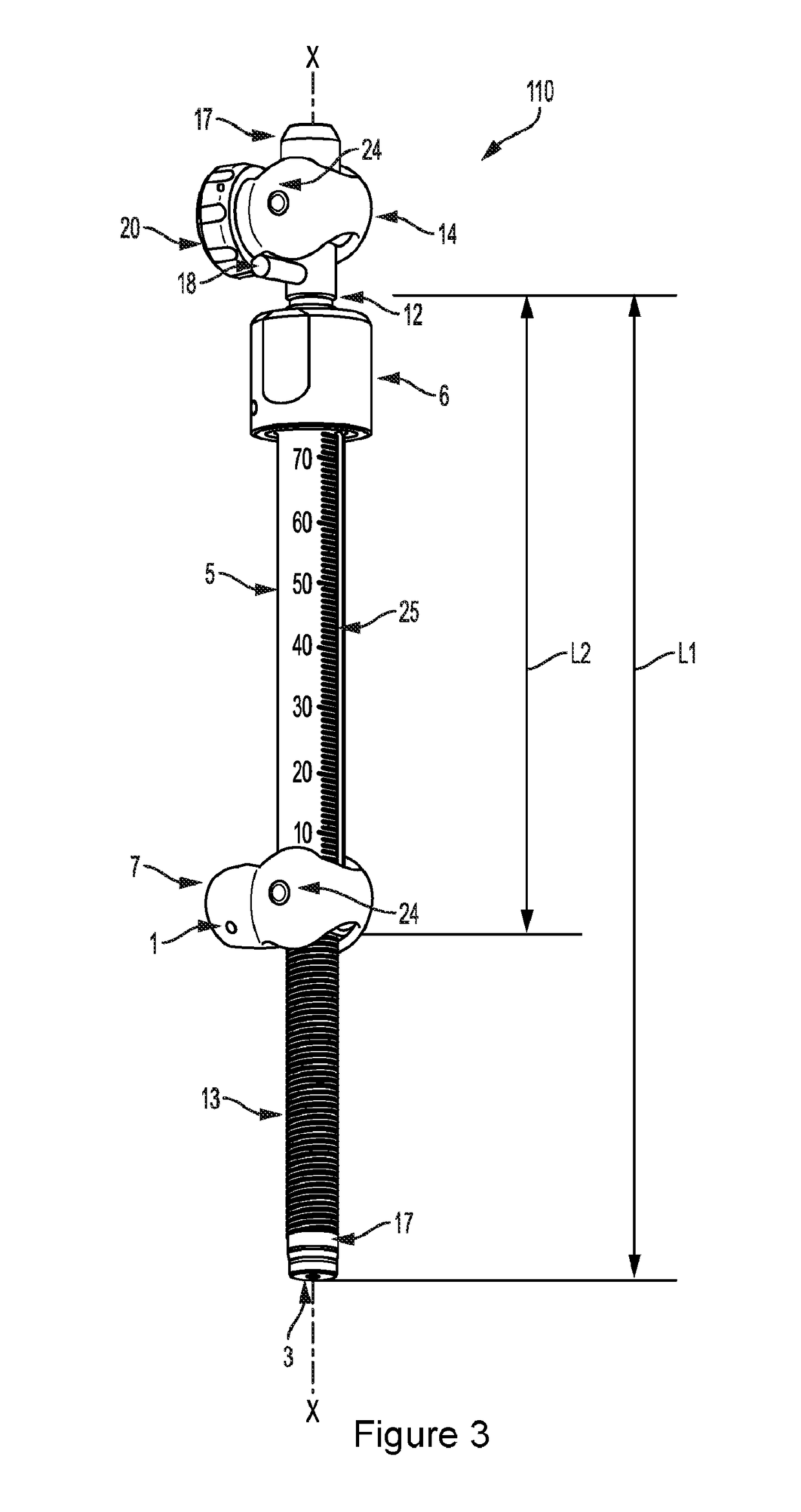 External bone fixation systems