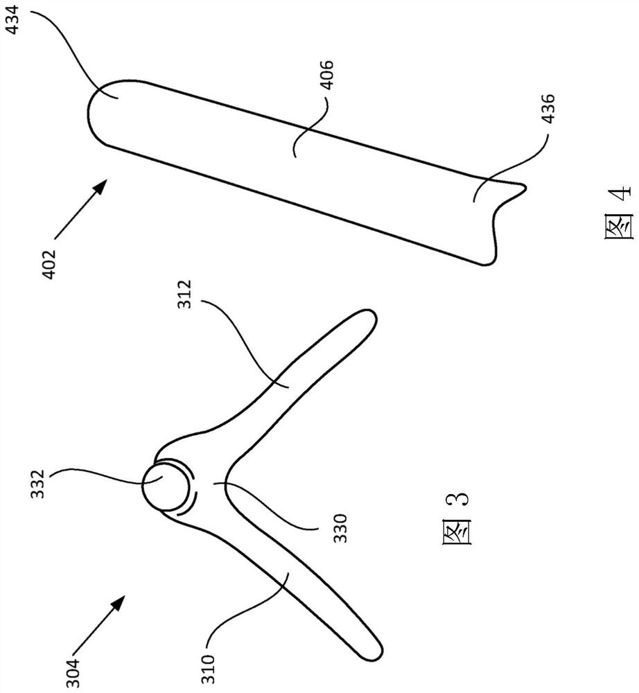 Penile implant for neophallus