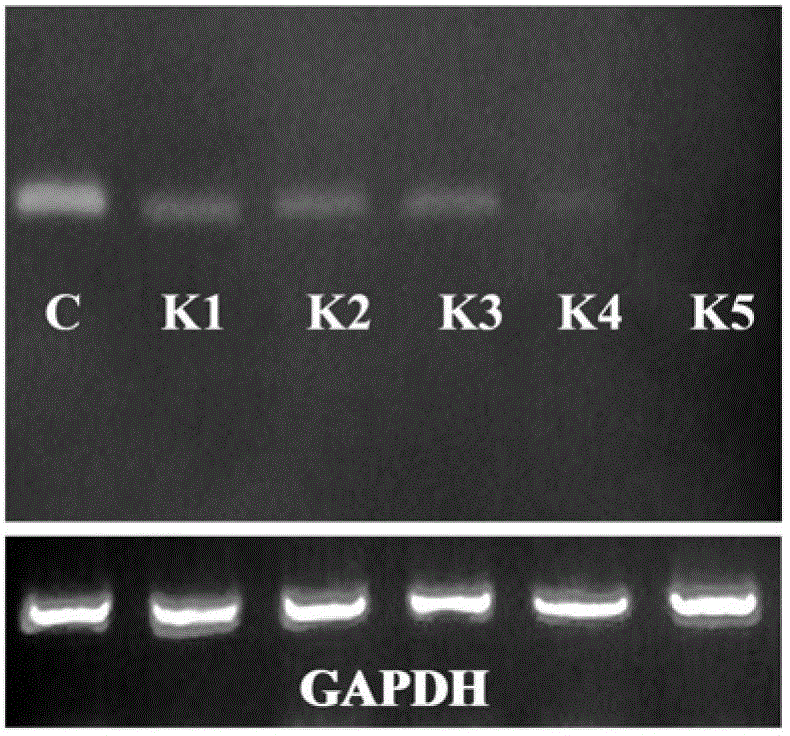 Small ribonucleic acid interference molecule for specifically inhibiting NK (Natural Killer) cell receptor KIR3DL1 and application of small ribonucleic acid interference molecule