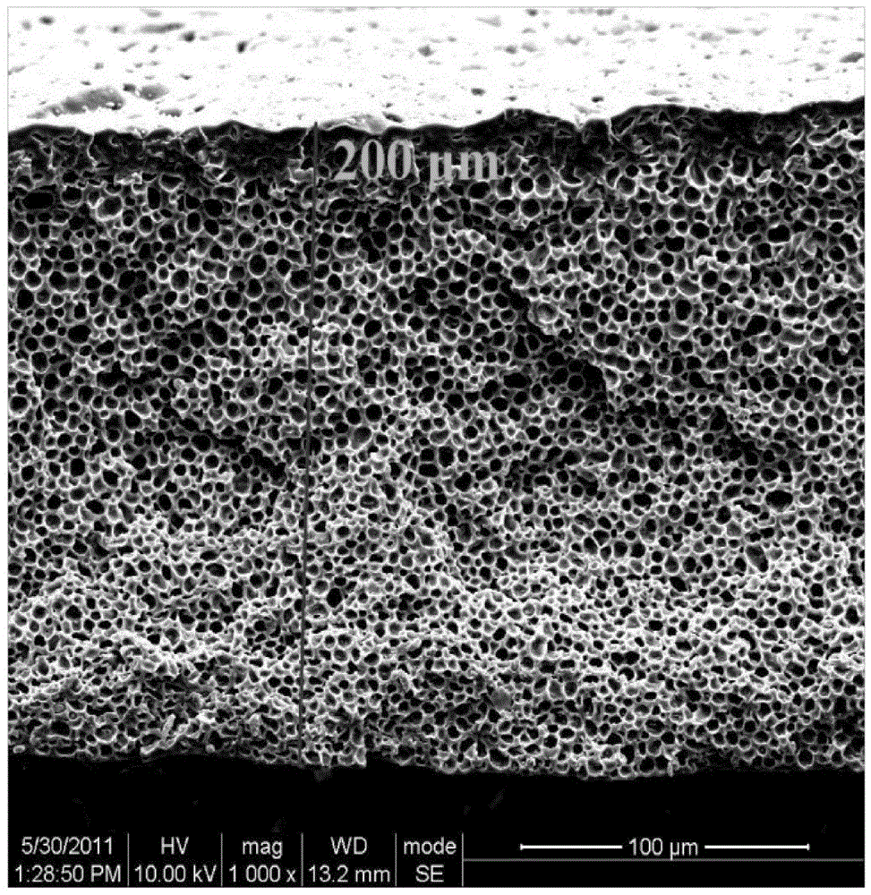 Breathable itching-relieving antisepsis scar treating paster and preparation method thereof