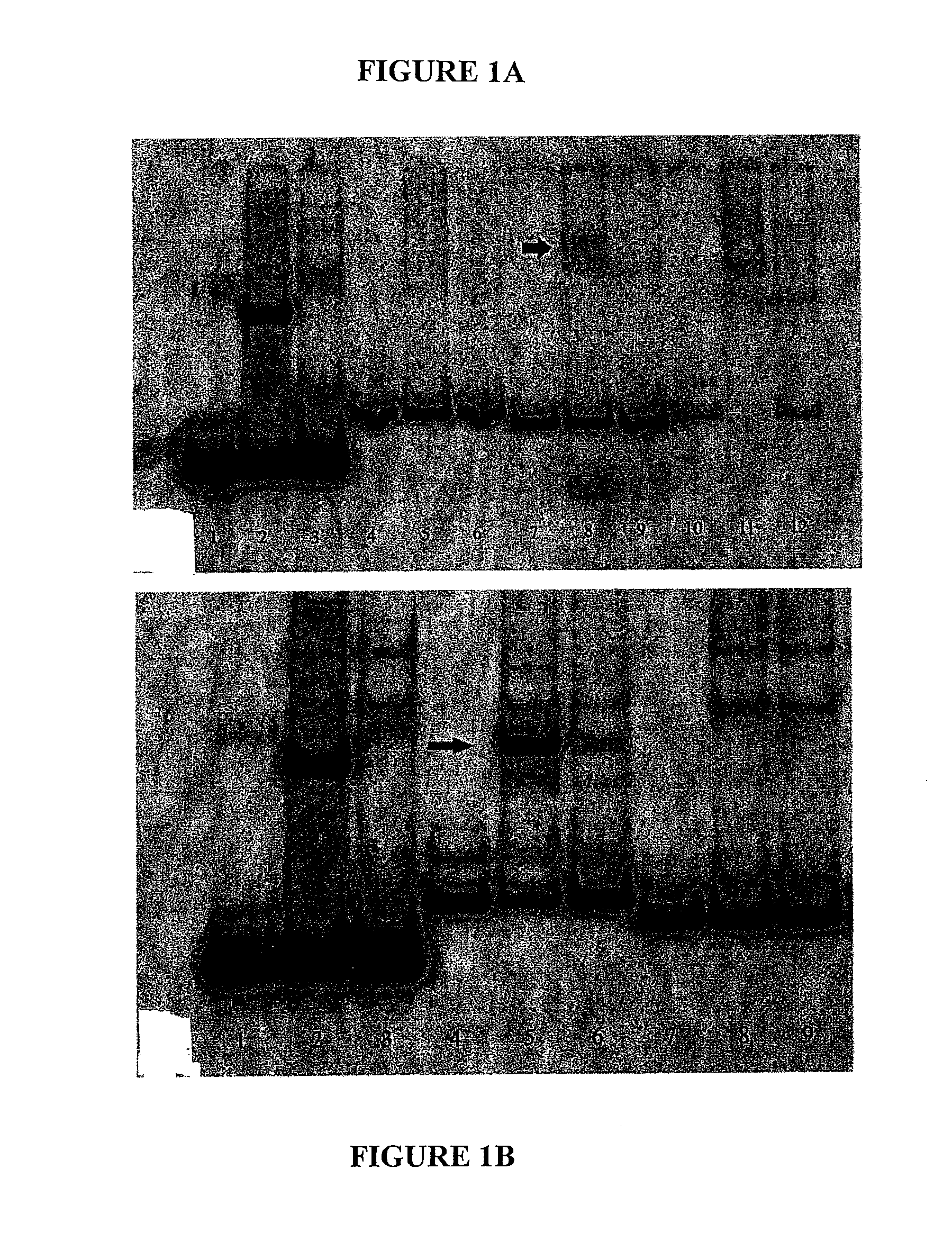 Sodium-iodide symporter gene repressor binding site