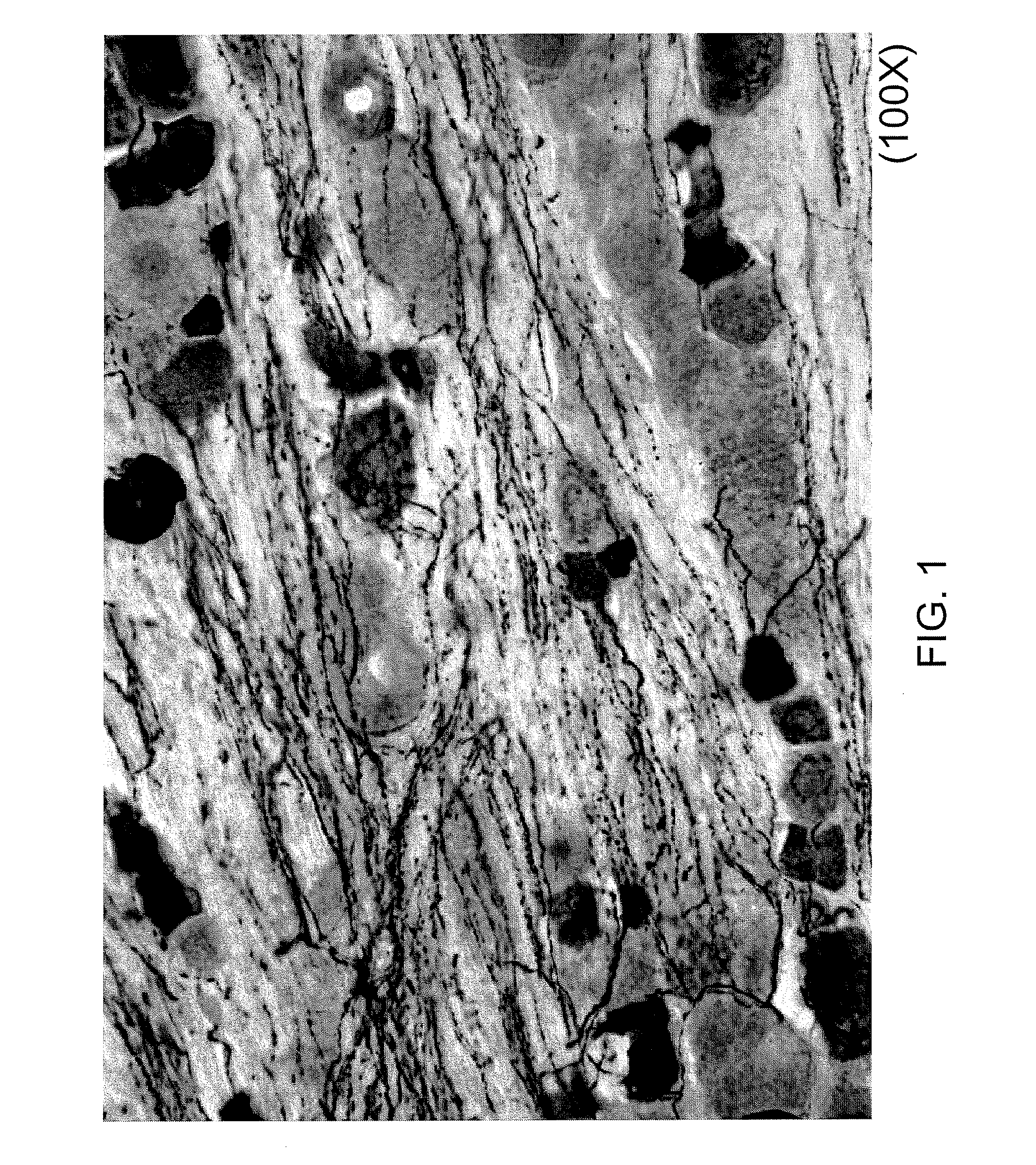 Selective ablation of pain-sensing neurons by administration of a vanilloid receptor agonist