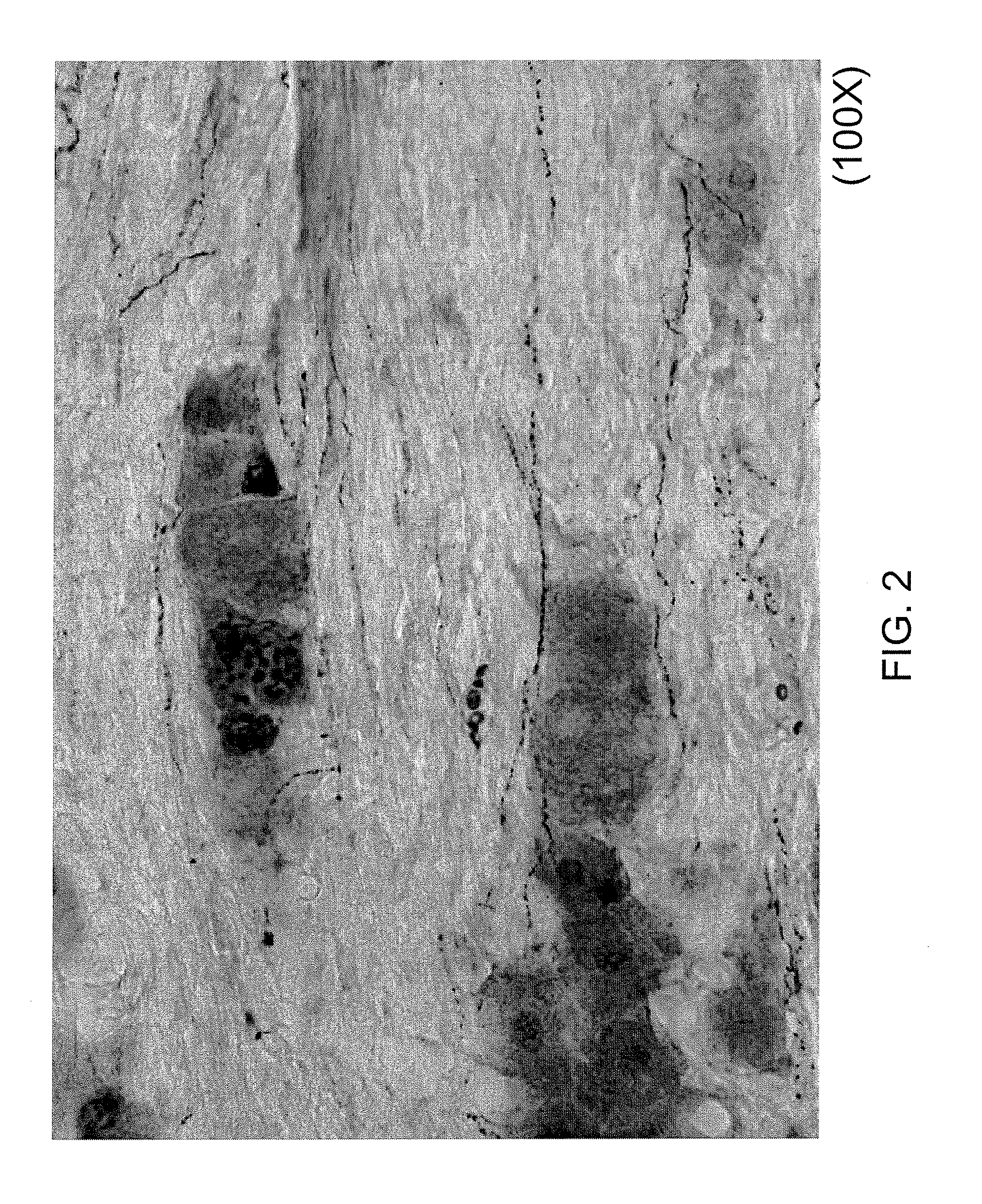 Selective ablation of pain-sensing neurons by administration of a vanilloid receptor agonist