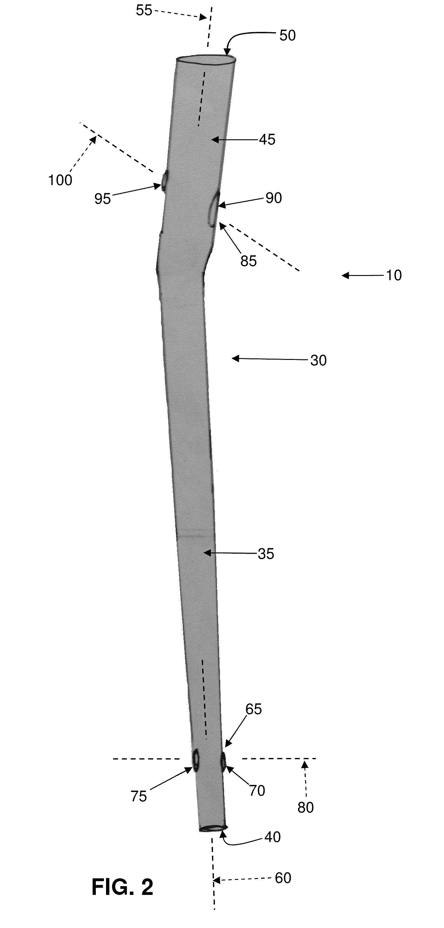 Interlocking intramedullary rod assembly for proximal femoral fractures, including unstable hip fractures