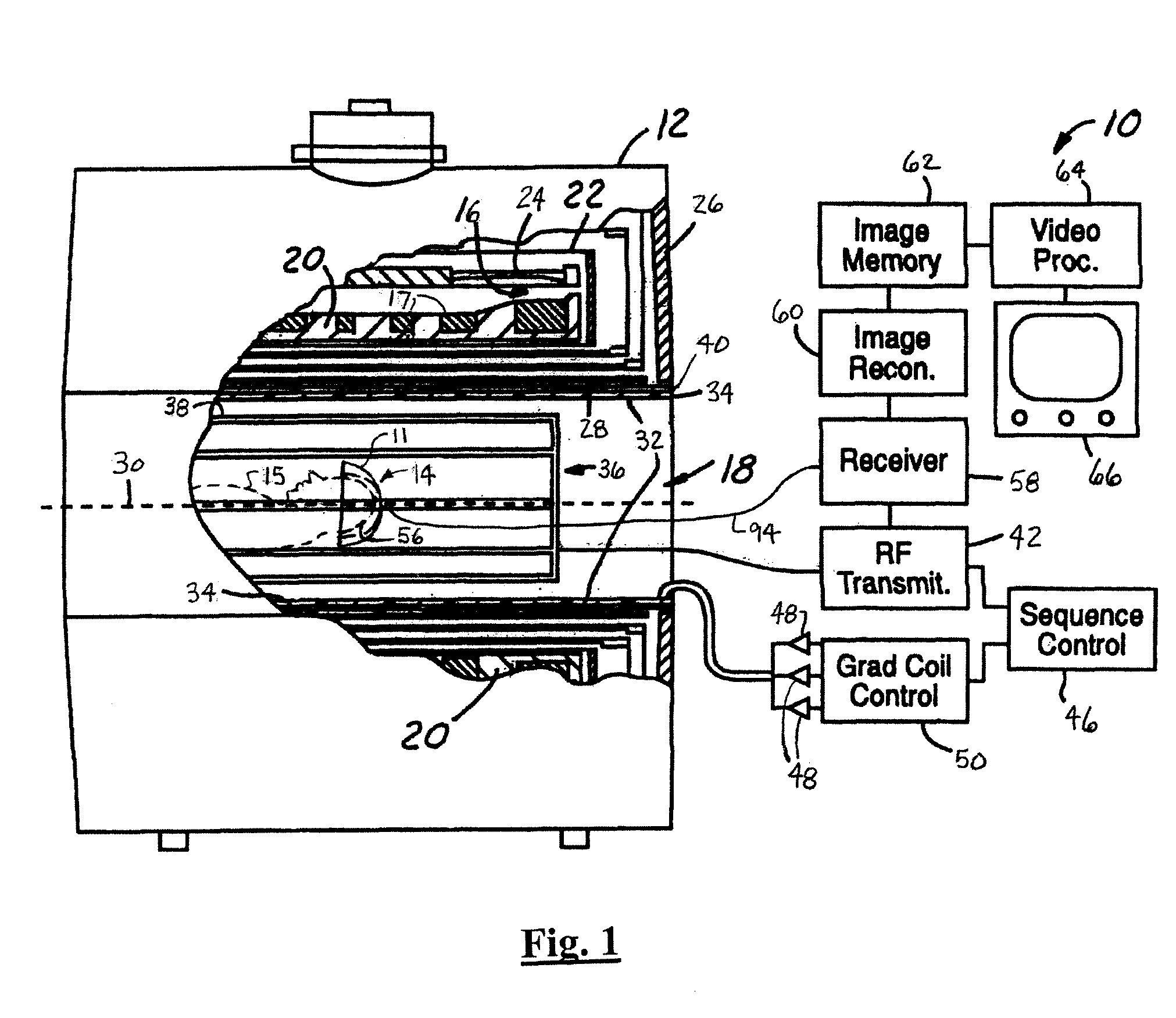 Shielded dome resonator for mr scanning of a cerebrum