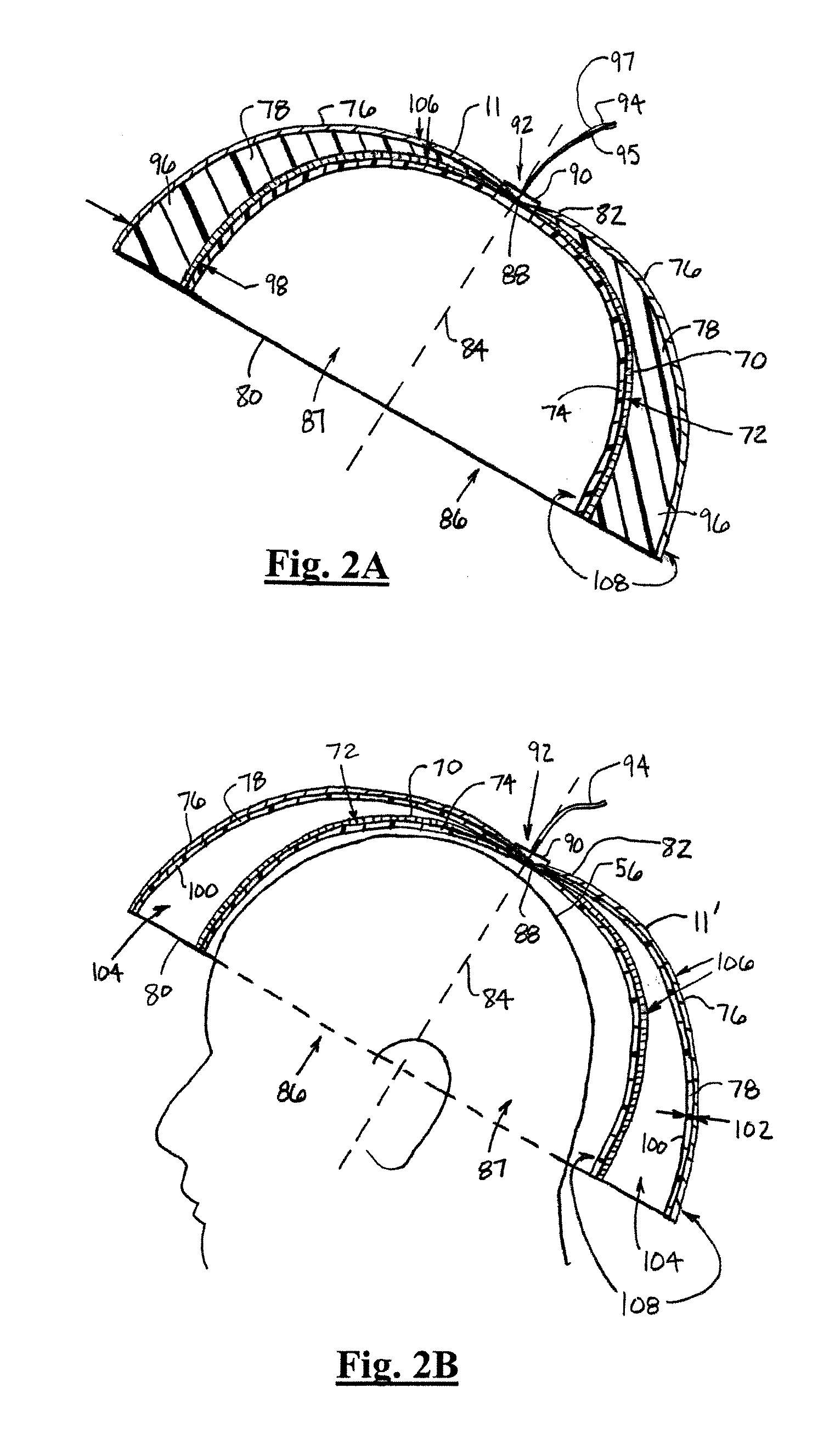 Shielded dome resonator for mr scanning of a cerebrum