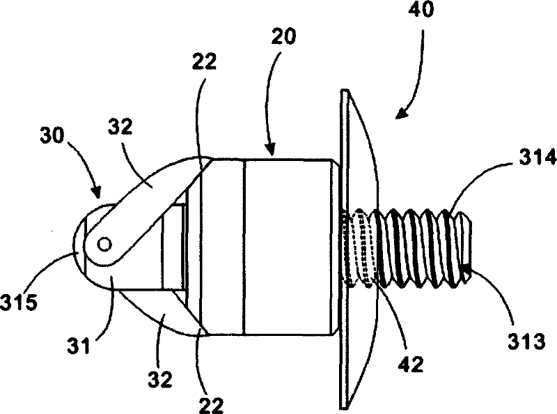 Supporting device of percutaneous expanding crest