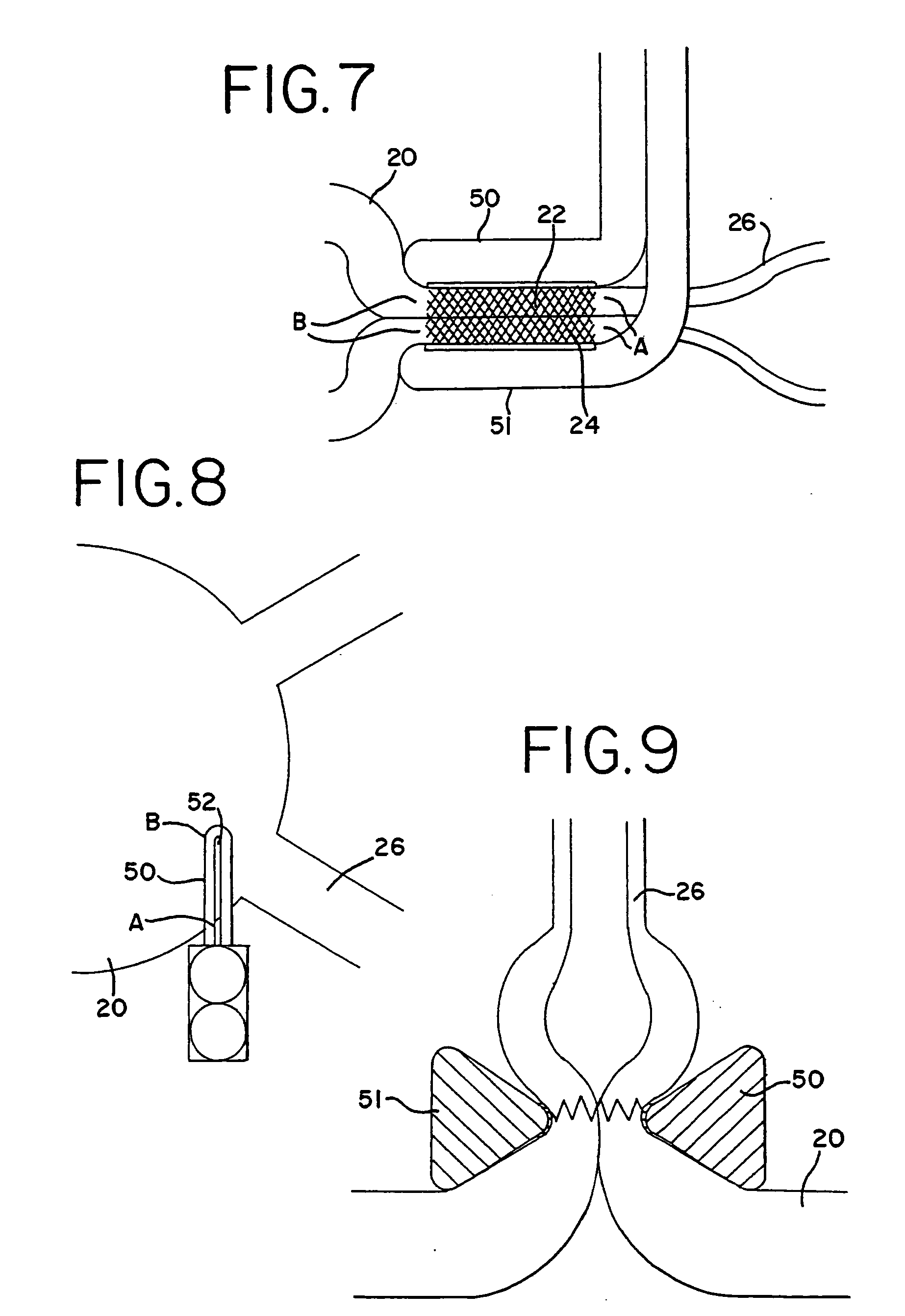 Transmural ablation device with parallel electrodes