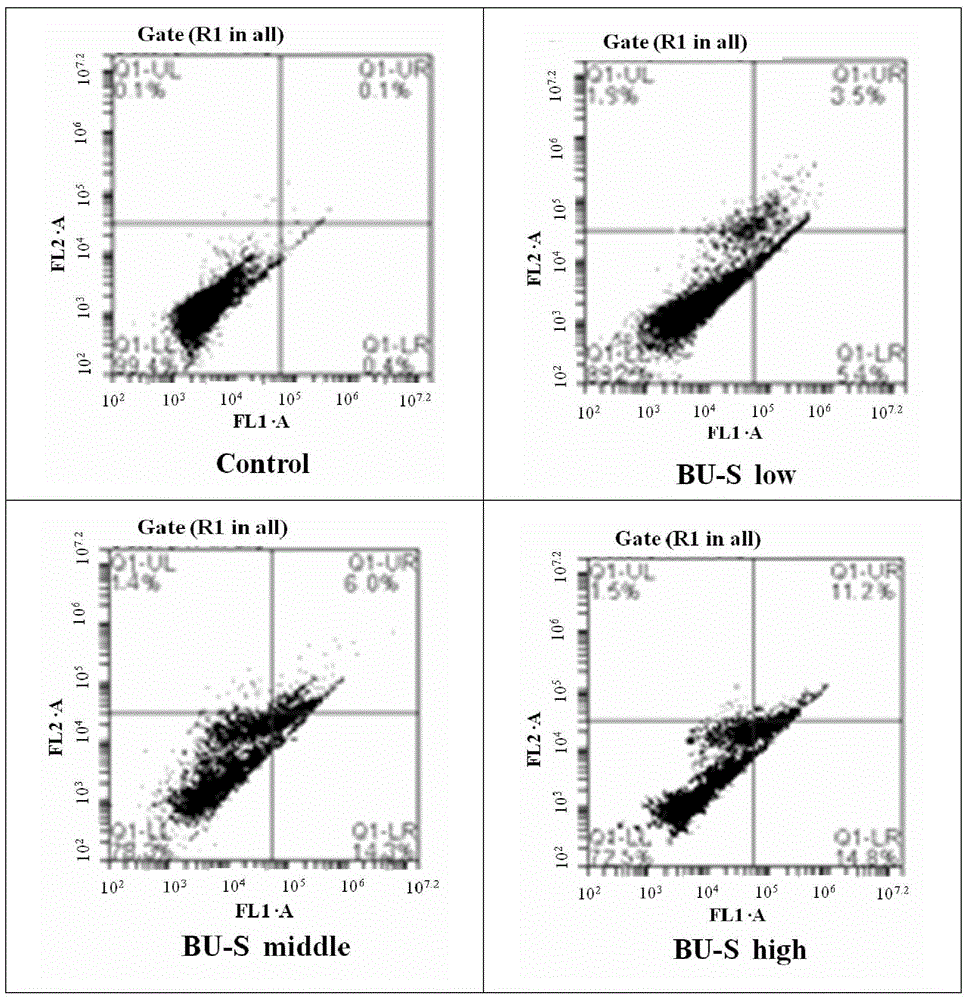 Preparation method of venenum bufonis extract and application thereof in preparation of anti-brain glioma medicine