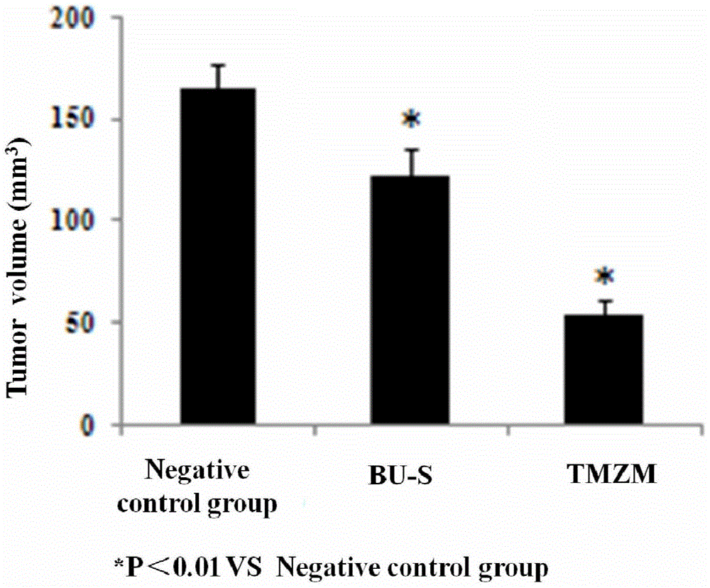 Preparation method of venenum bufonis extract and application thereof in preparation of anti-brain glioma medicine