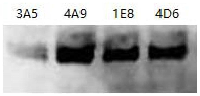 Salmon trout ihnv monoclonal antibody and its detection kit and application