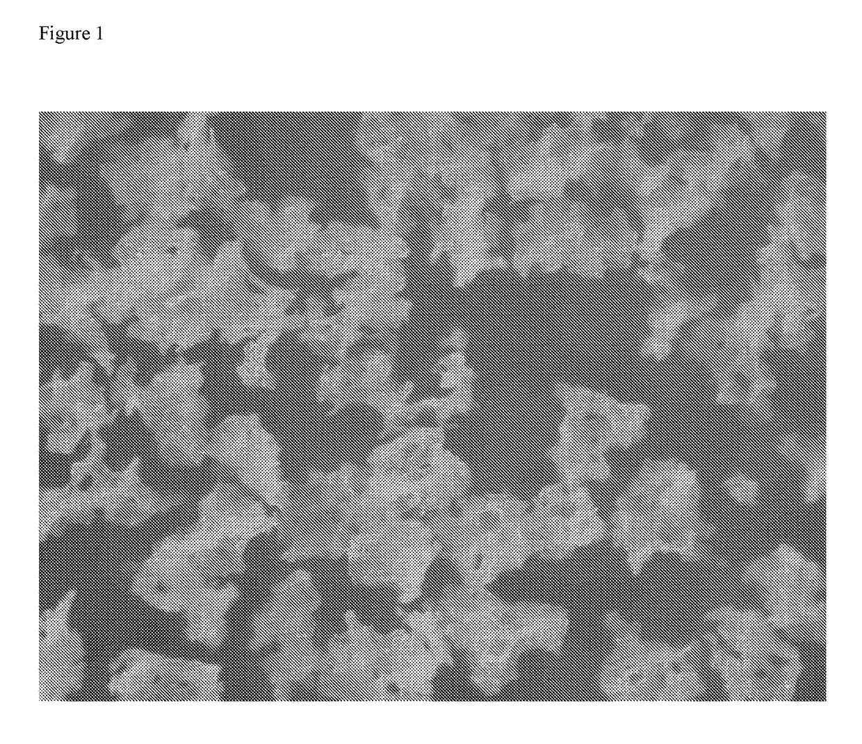 Process for the synthesis of poly (vinyl alcohol) and/or poly (vinyl acetate) with spherical morphology and shell-and-nucleus structure and its use in vascular embolization