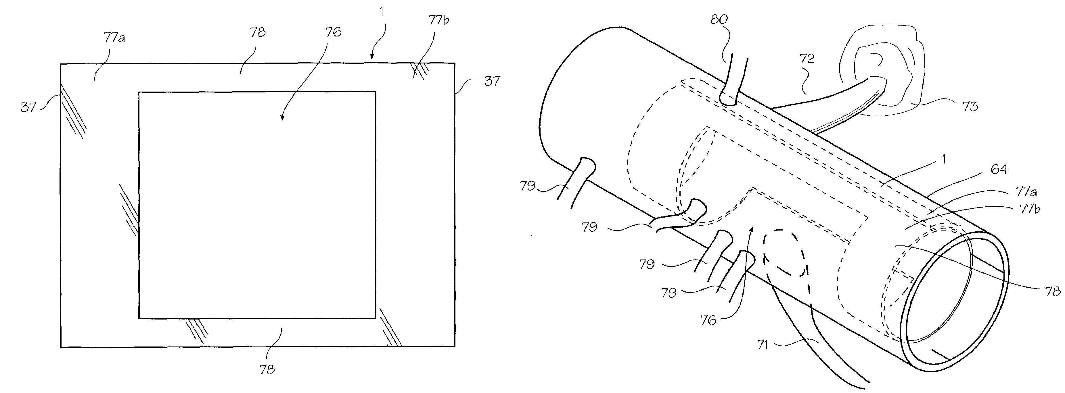 Intracranial stent and method of use