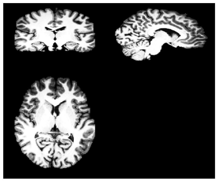 Automatic sketching method and sketching system for brain function region of MRI head image, computing device and storage medium