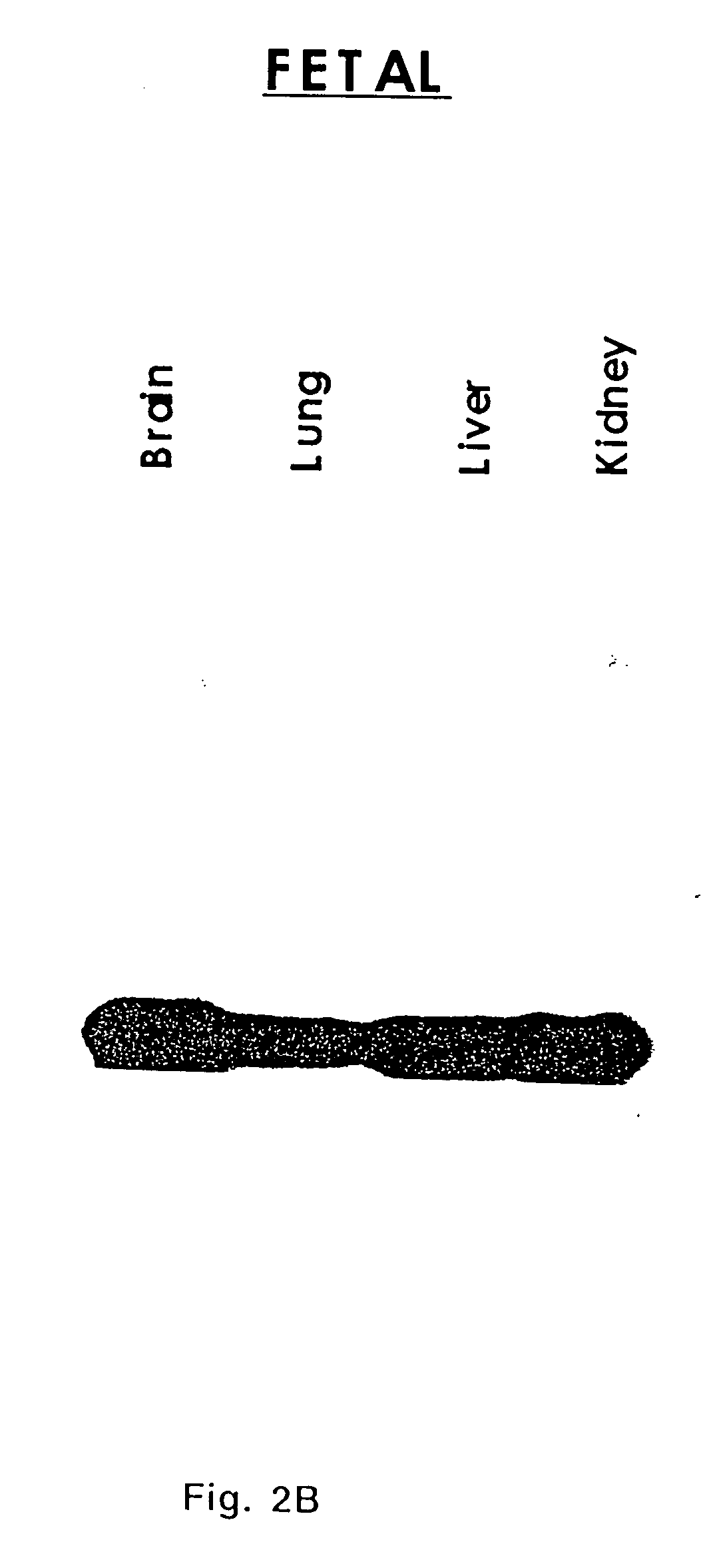 Extracellular serine protease