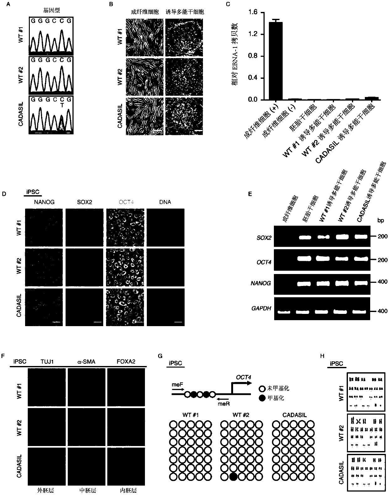 Method for preparing specific vascular smooth muscle cells and vascular endothelial cells of CADASIL patients