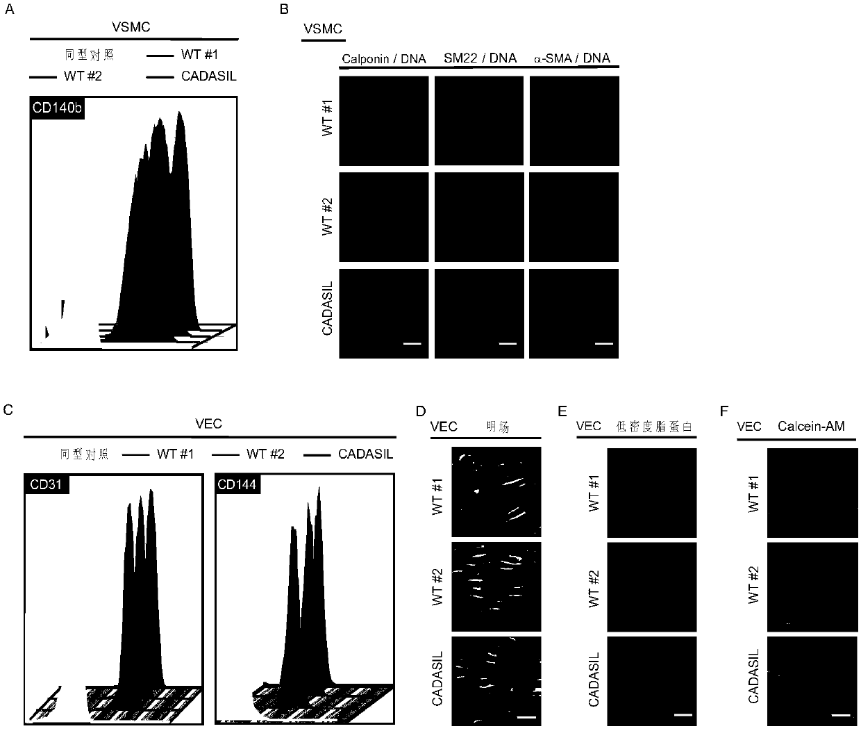 Method for preparing specific vascular smooth muscle cells and vascular endothelial cells of CADASIL patients