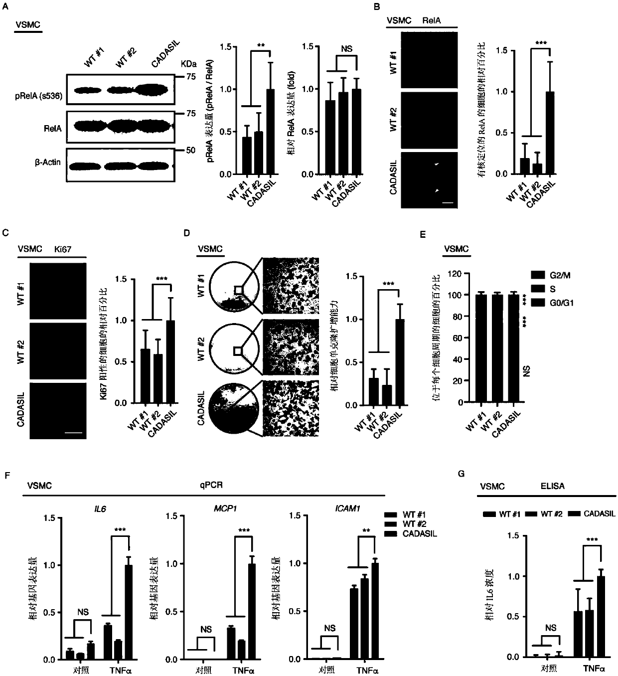 Method for preparing specific vascular smooth muscle cells and vascular endothelial cells of CADASIL patients