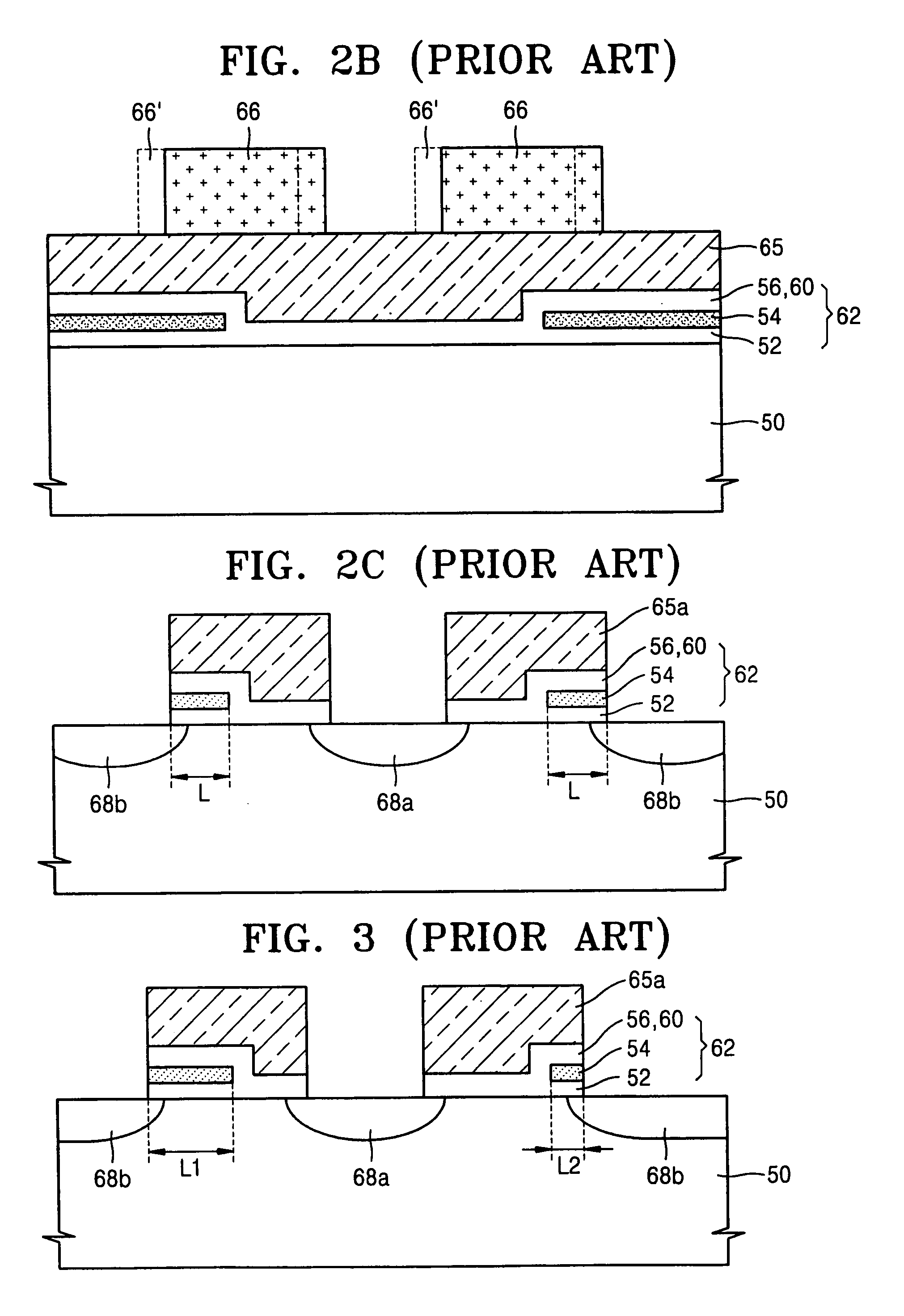 Local SONOS-type nonvolatile memory device and method of manufacturing the same