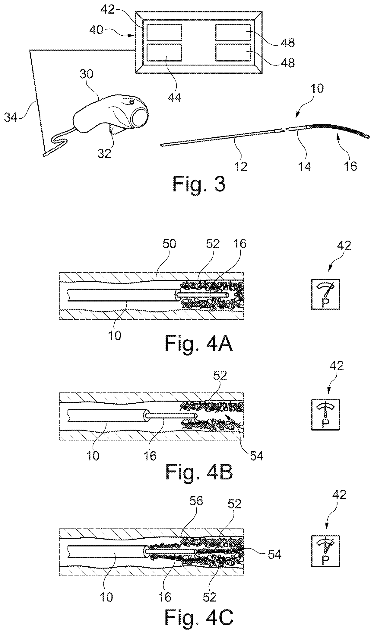 Apparatus and method of occluding a vessel by ablation