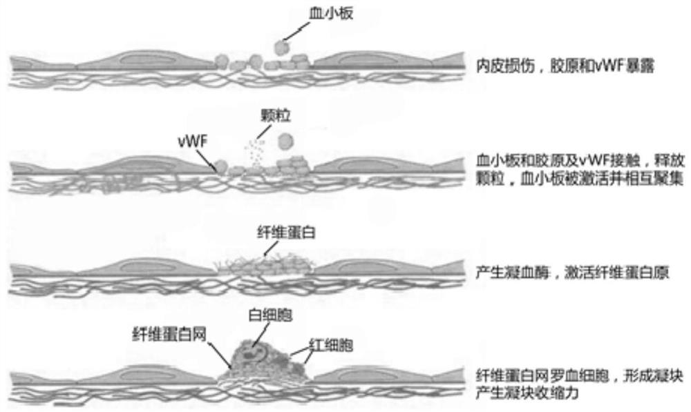 A flexible microcolumn ring array for detecting clot contractility and its preparation method and application