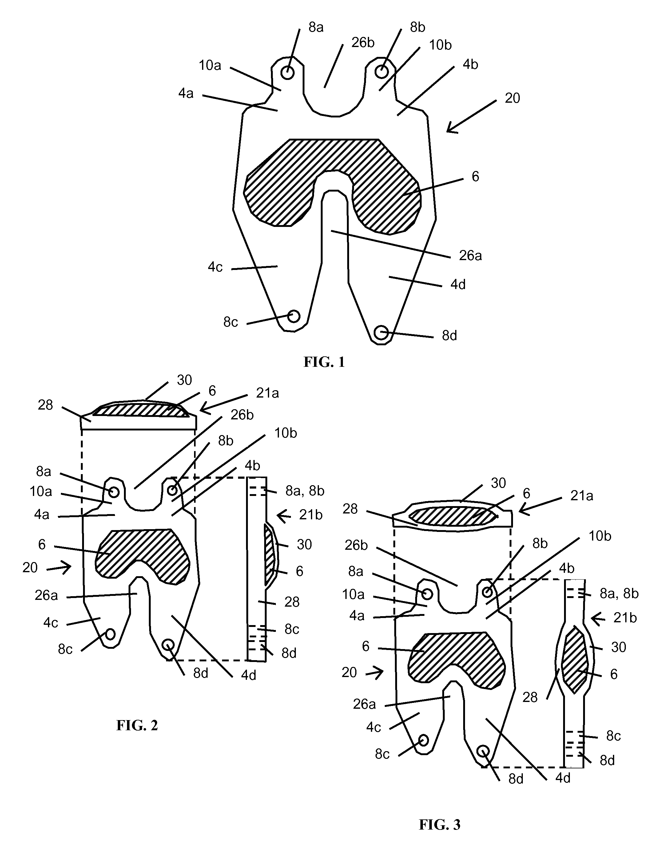 Resilient knee implant and methods