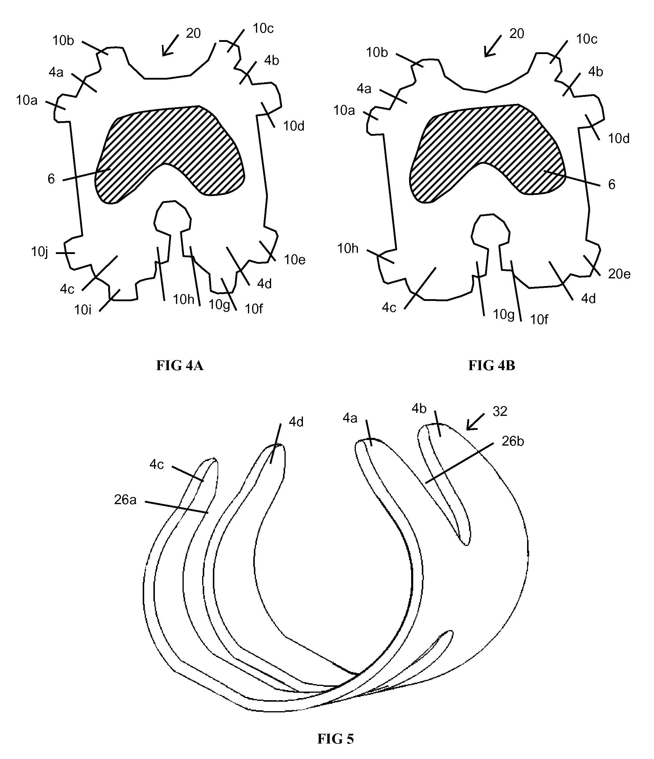 Resilient knee implant and methods