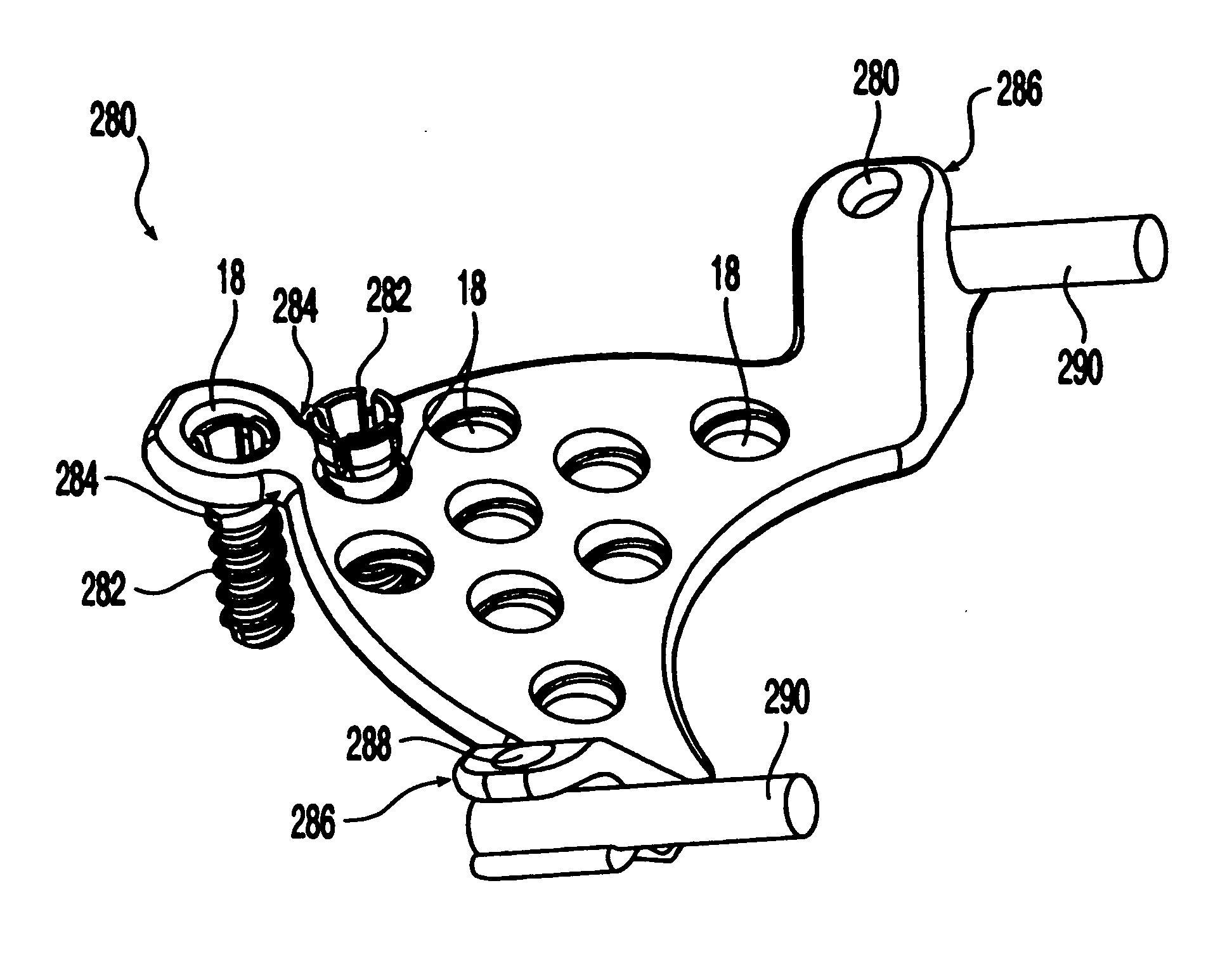 Occipital plate and system for spinal stabilization