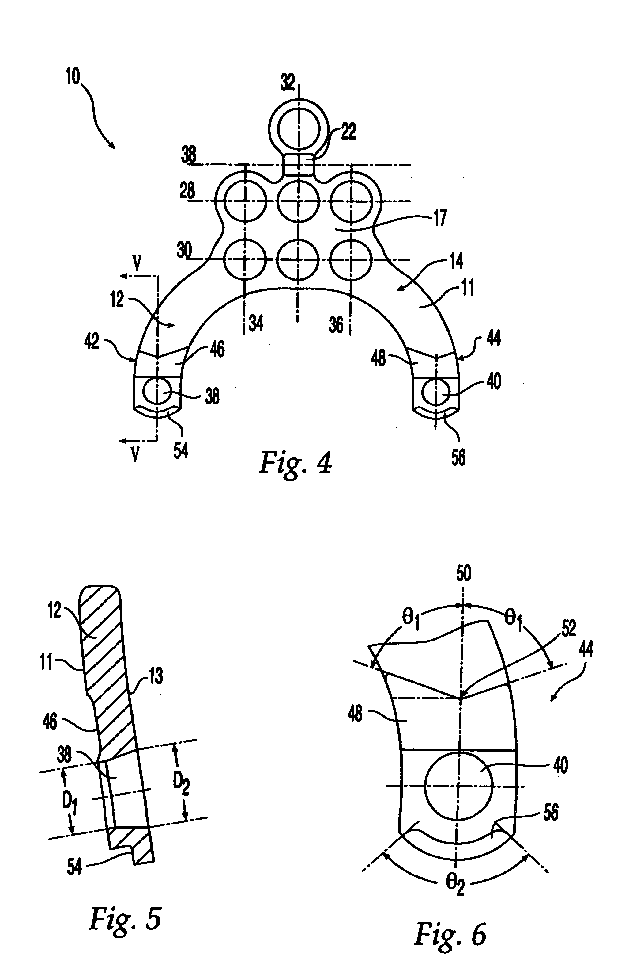 Occipital plate and system for spinal stabilization